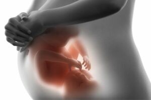 Pregnancy Constipation